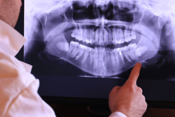 Best Emergency Dental Care for Trauma or Injury in North Madison, OH